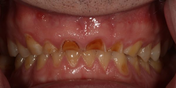 Treatment Category - Harcourt Dental Clinic