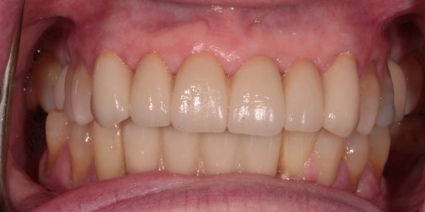 Treatment Category - Harcourt Dental Clinic
