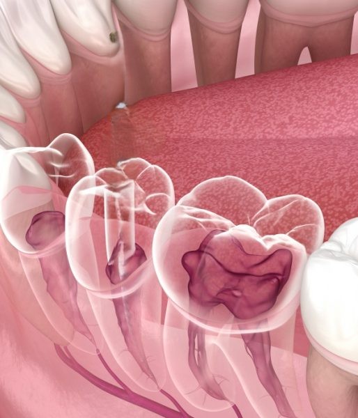 Treatment -  Harcourt Dental Clinic
