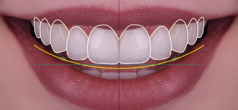 Digital Smile Design