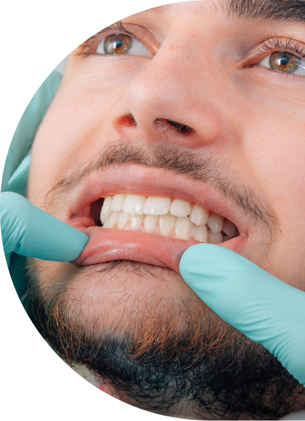 Gum disease