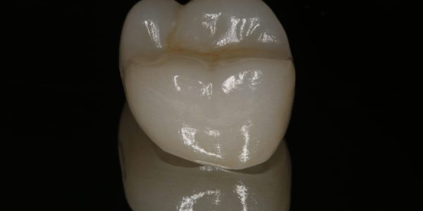 Treatment Category - Harcourt Dental Clinic
