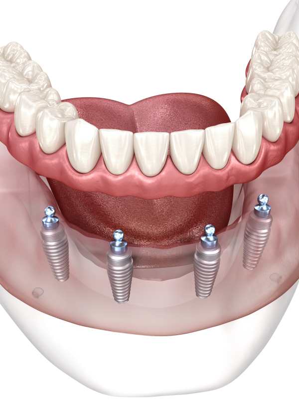 Harcourt Dental Clinic