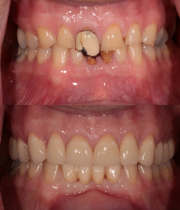 Treatment -  Harcourt Dental Clinic