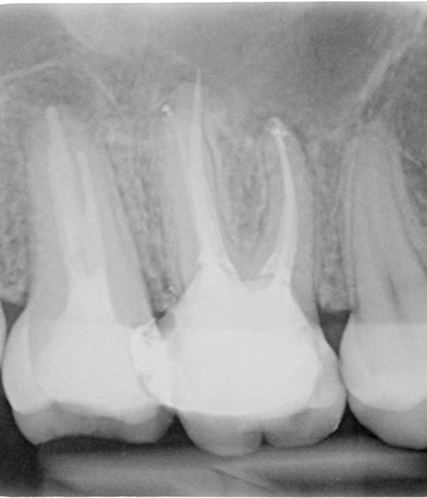Treatment -  Harcourt Dental Clinic