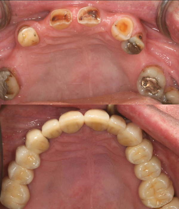 Treatment -  Harcourt Dental Clinic