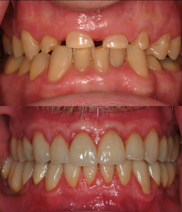 Treatment -  Harcourt Dental Clinic