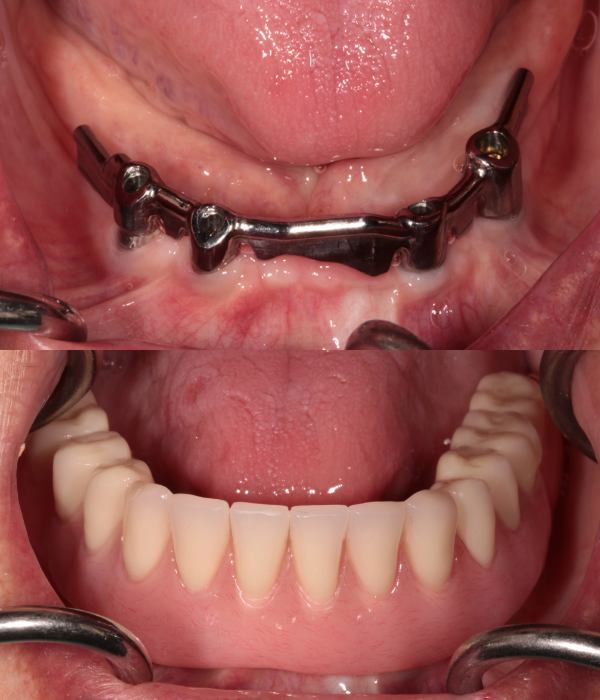 Treatment -  Harcourt Dental Clinic