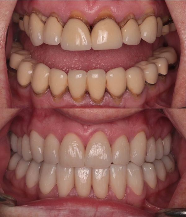 Treatment -  Harcourt Dental Clinic