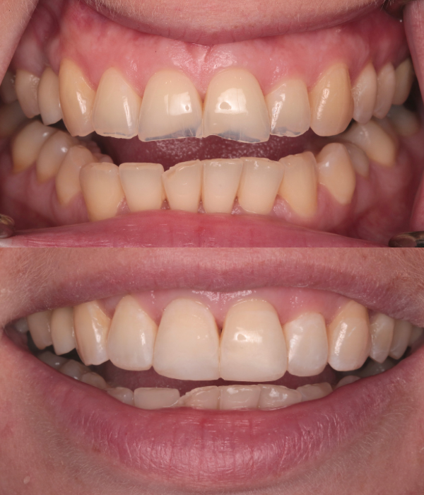 Treatment -  Harcourt Dental Clinic