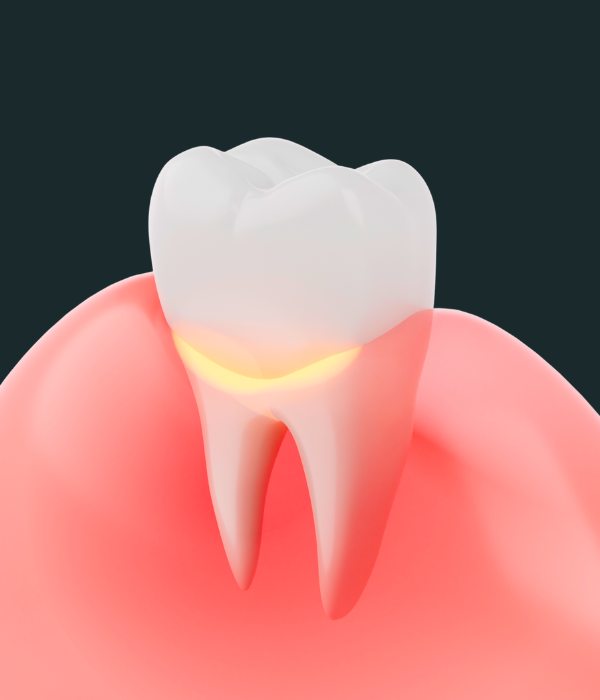 Treatment -  Harcourt Dental Clinic