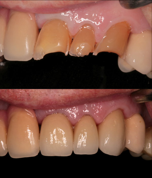 Treatment -  Harcourt Dental Clinic