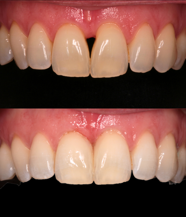 Treatment -  Harcourt Dental Clinic