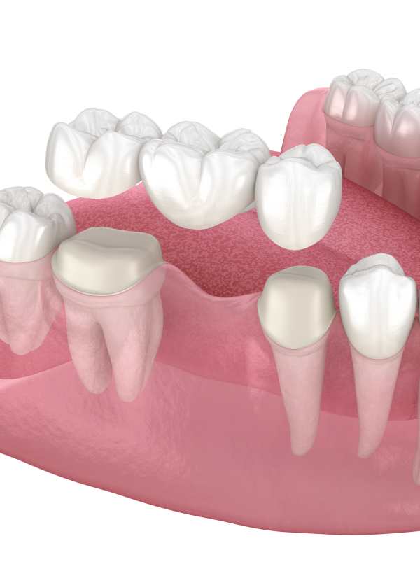 Harcourt Dental Clinic