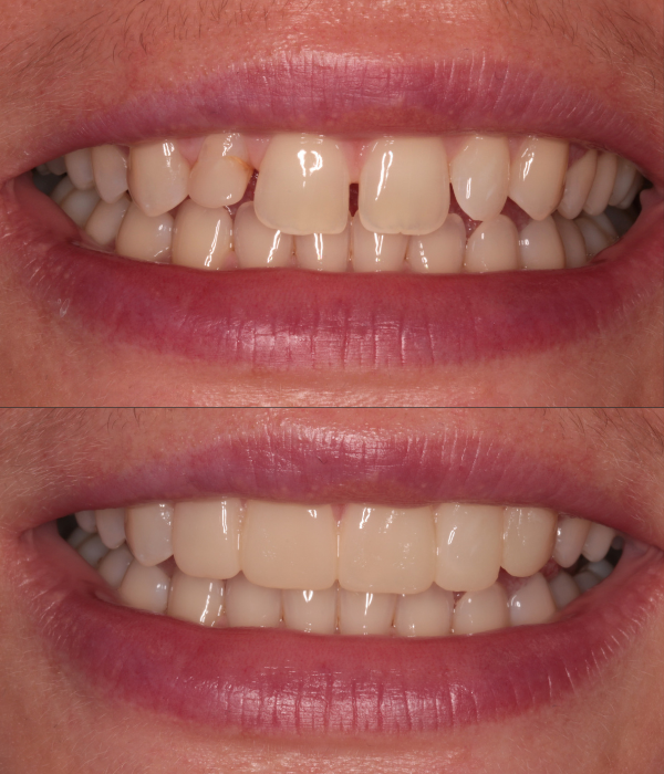 Treatment -  Harcourt Dental Clinic