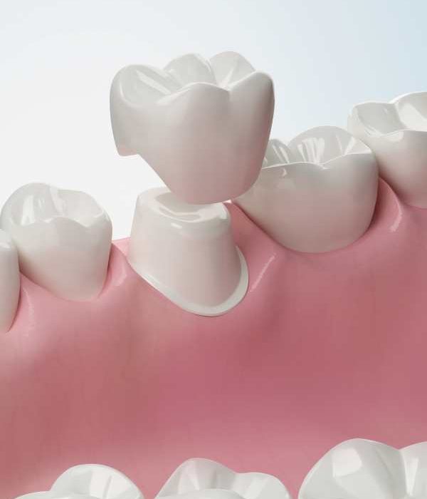 Treatment -  Harcourt Dental Clinic