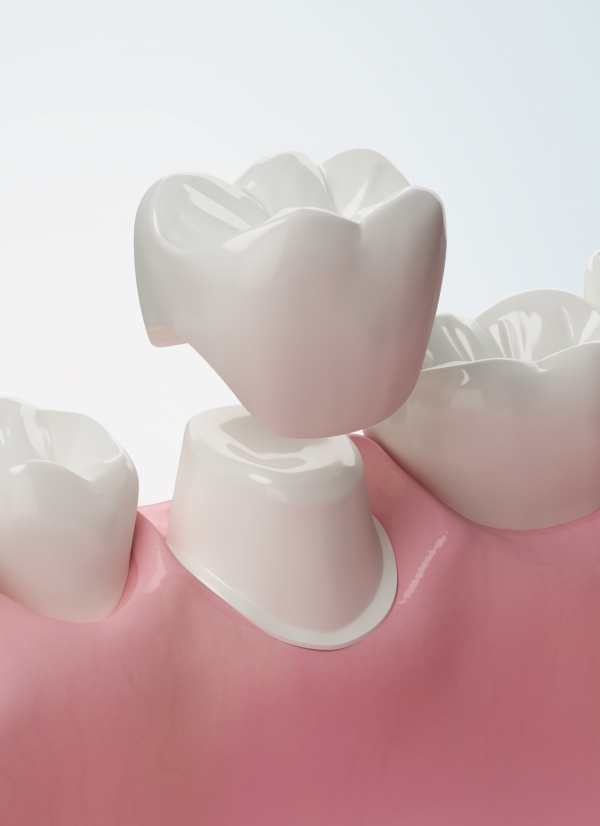 Harcourt Dental Clinic