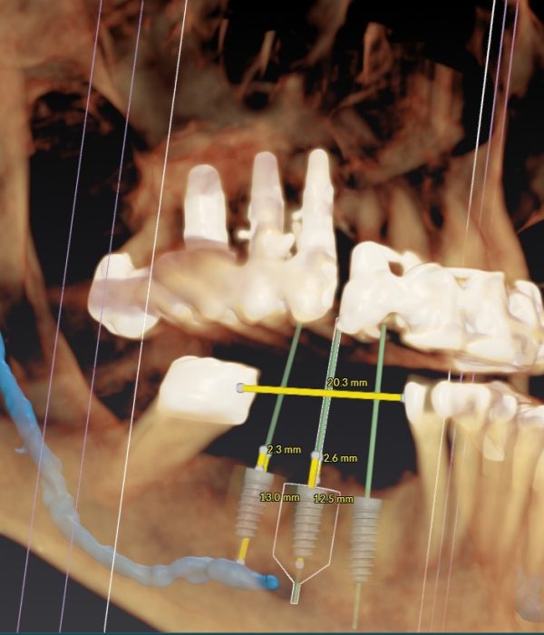 Treatment -  Harcourt Dental Clinic