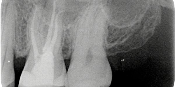 Treatment Category - Harcourt Dental Clinic