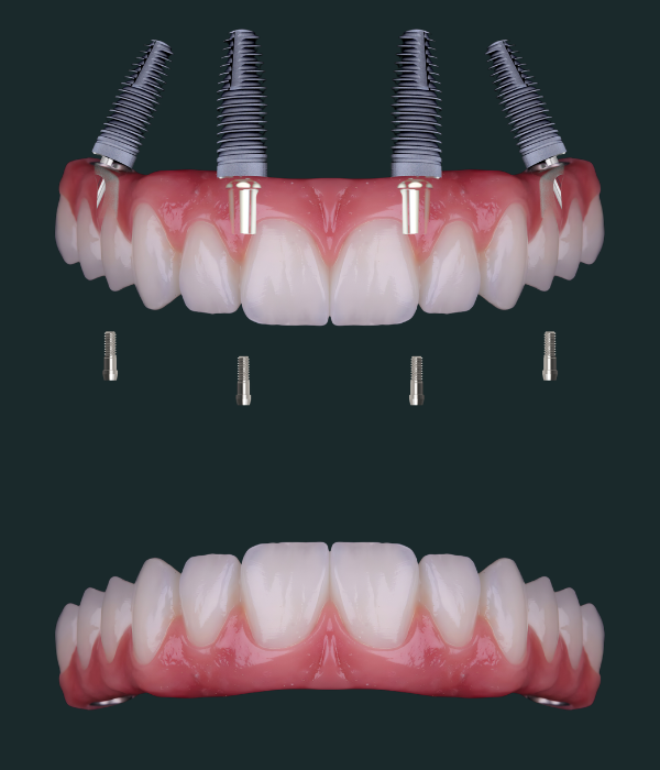 Treatment -  Harcourt Dental Clinic