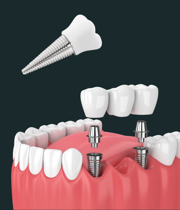 Treatment -  Harcourt Dental Clinic
