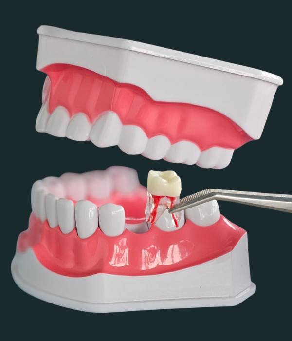 Treatment -  Harcourt Dental Clinic