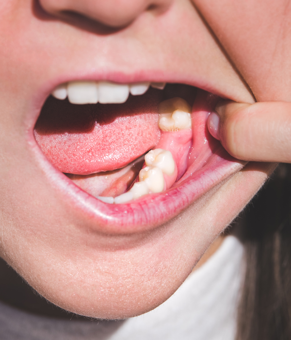 Treatment -  Harcourt Dental Clinic