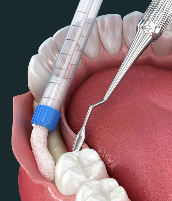 Treatment -  Harcourt Dental Clinic