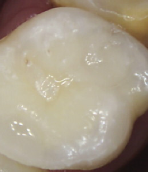 Treatment -  Harcourt Dental Clinic