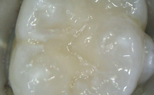After - Harcourt Dental Clinic