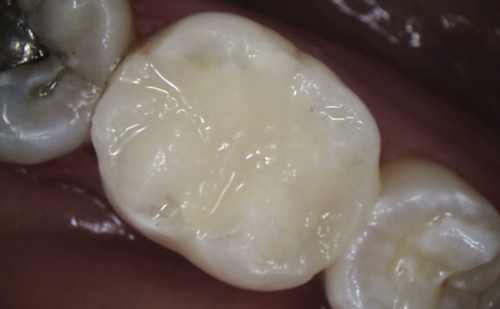 After - Harcourt Dental Clinic