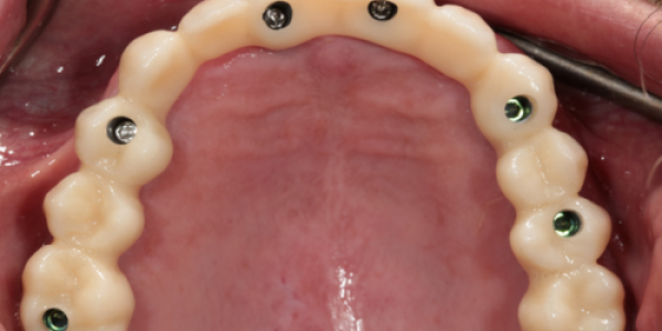 Treatment Category - Harcourt Dental Clinic