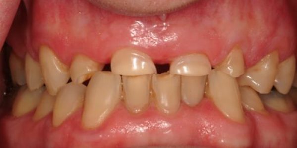 Treatment Category - Harcourt Dental Clinic