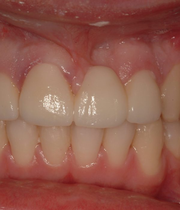 Treatment -  Harcourt Dental Clinic