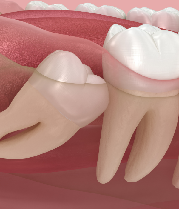 Treatment -  Harcourt Dental Clinic