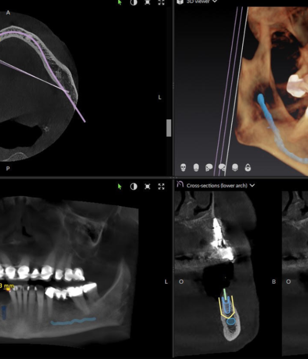 Treatment -  Harcourt Dental Clinic